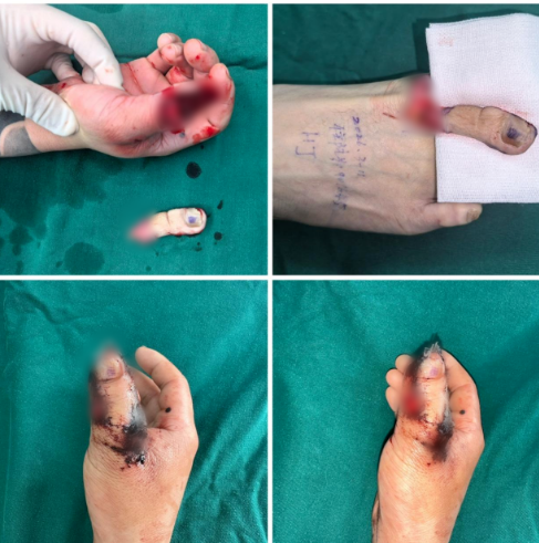 QQ20260316-100551.jpg QQ20260316-100551.jpg