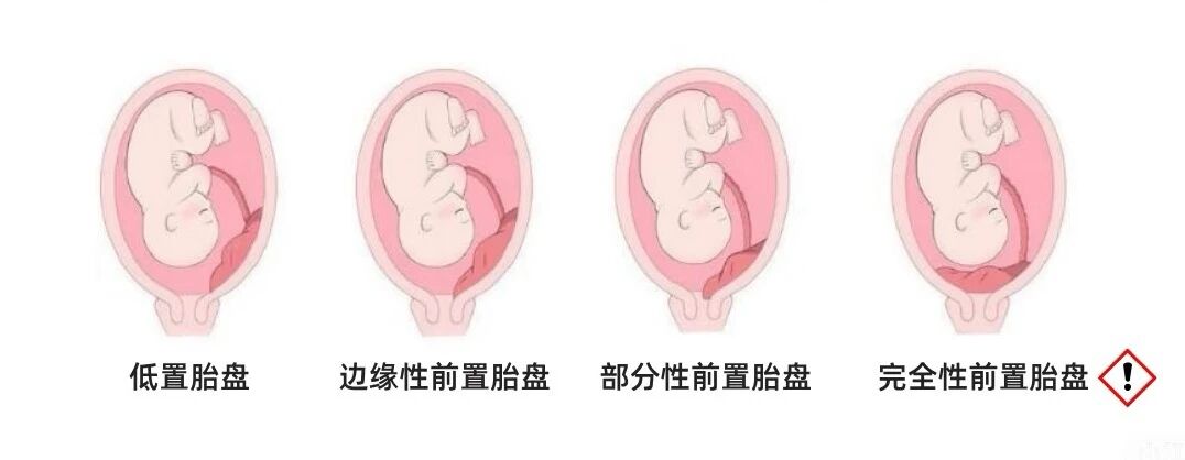 微信图片_2026-03-29_153019_636.jpg 微信图片_2026-03-29_153019_636.jpg